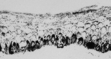 a section through skin showing melanin