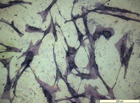 Cells grown on hydrogel, A light microscope magnification of fibroblast cells growing on a hydrogel substrate - taken from a PhD student working for Professor Rimmer and used with his permission.