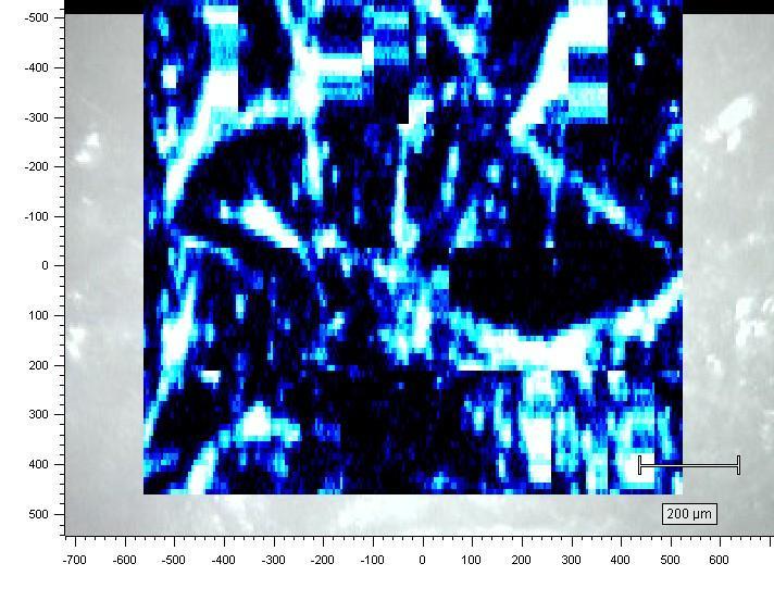 Raman map of skin sample